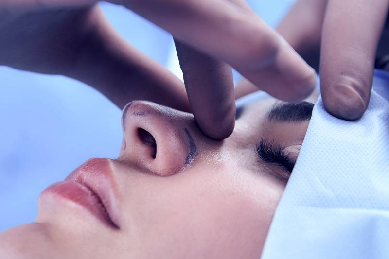 Dorsal preservation : aplanir la bosse sans la couper