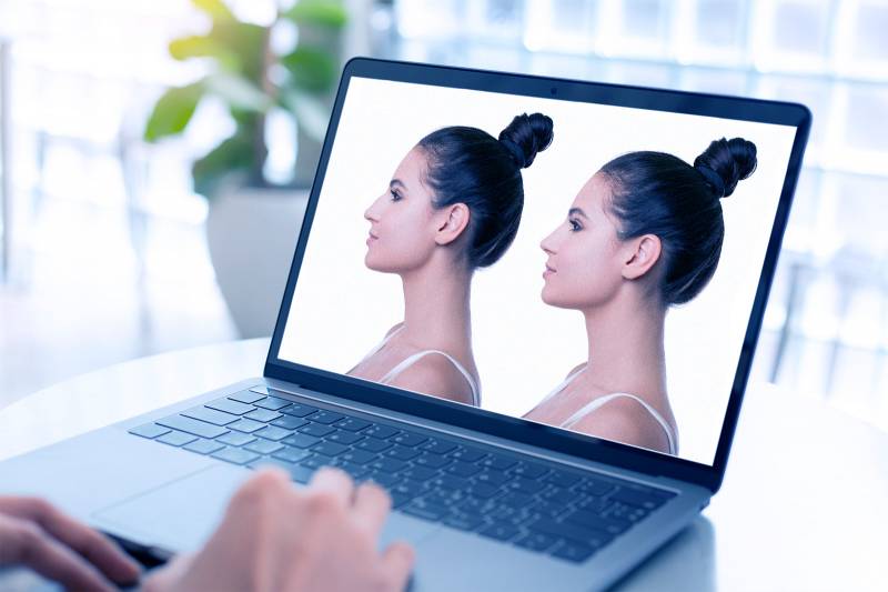 Quel est le rôle de la simulation en rhinoplastie ?